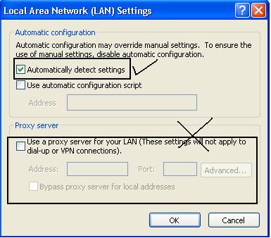 Automatically detect settings LAN